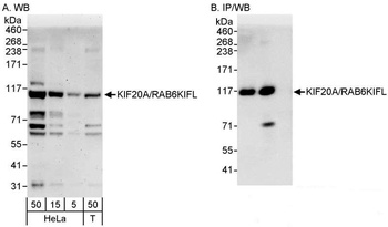 Rabbit anti-KIF20A/RAB6KIFL Antibody