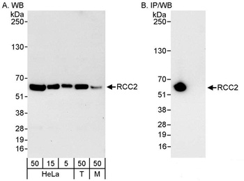 Rabbit anti-RCC2 Antibody