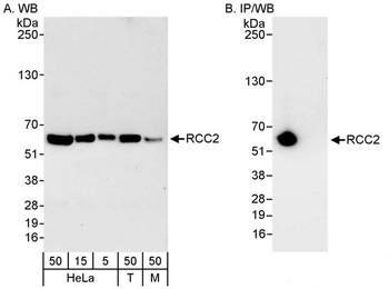 RCC2 Antibody