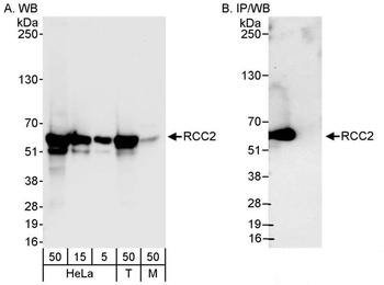 Rabbit anti-RCC2 Antibody