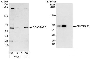 Rabbit anti-CDK5RAP3 Antibody