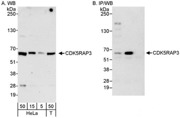 Rabbit anti-CDK5RAP3 Antibody