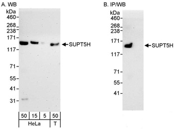 Rabbit anti-SUPT5H Antibody