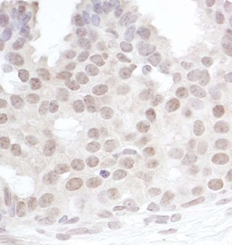 Gemin4 Antibody