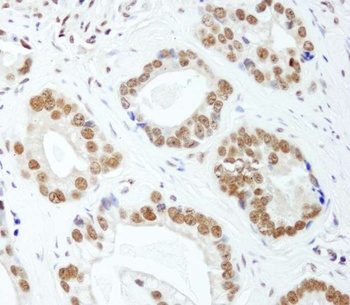 E1B-AP5 Antibody