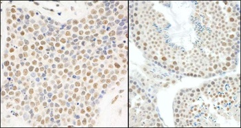 Rabbit anti-E1B-AP5 Antibody