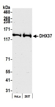 DHX37 Antibody