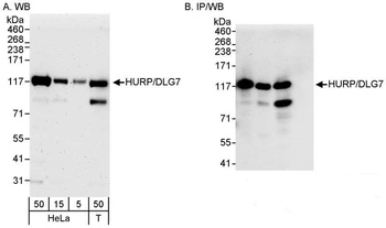 HURP/DLG7 Antibody