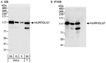 Rabbit anti-HURP/DLG7 Antibody