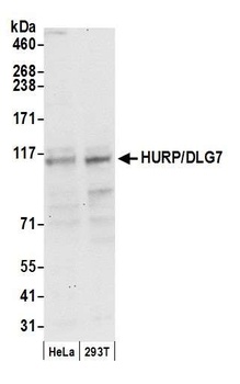 HURP/DLG7 Antibody