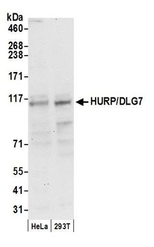 Rabbit anti-HURP/DLG7 Antibody