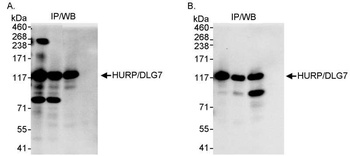 Rabbit anti-HURP/DLG7 Antibody