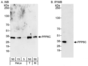 PPP6C Antibody