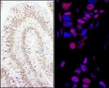 Rabbit anti-PPP4R3 Alpha Antibody