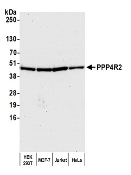 PPP4R2 Antibody