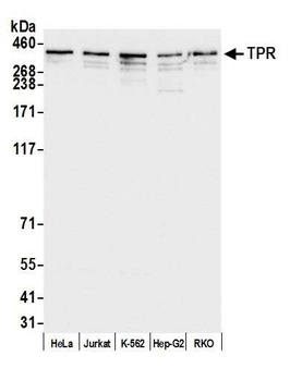 TPR Antibody