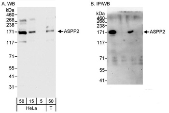 ASPP2 Antibody
