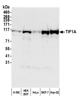 TIF1 Alpha/TRIM24 Antibody
