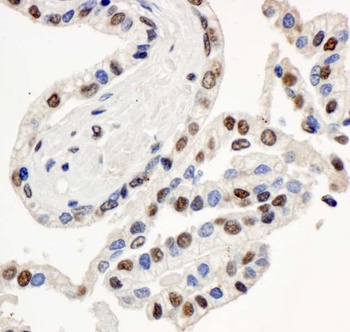 Rabbit anti-BAF57/SMARCE1 Antibody