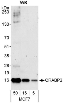 Rabbit anti-CRABP2 Antibody