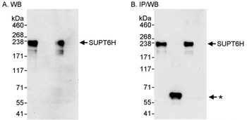Rabbit anti-SUPT6H Antibody
