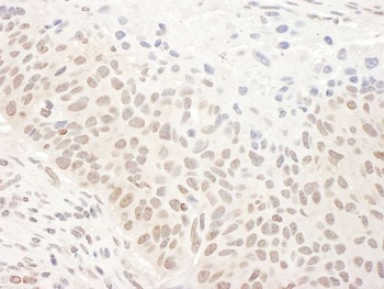 DHX33 Antibody