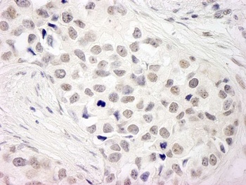 Rabbit anti-NCOA5/CIA Antibody