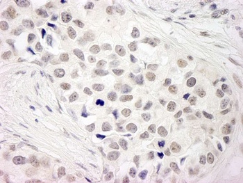 NCOA5/CIA Antibody