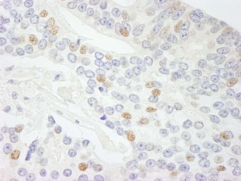 Rabbit anti-NCOA5/CIA Antibody