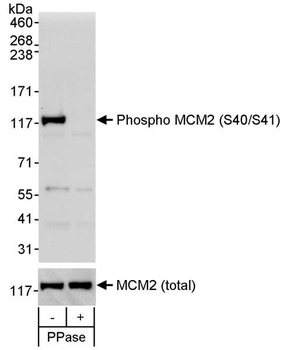 Rabbit anti-Phospho MCM2 (S40/S41) Antibody
