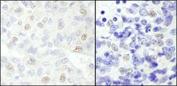 NCOA62 Antibody