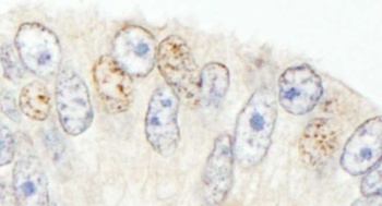 NCOA62 Antibody