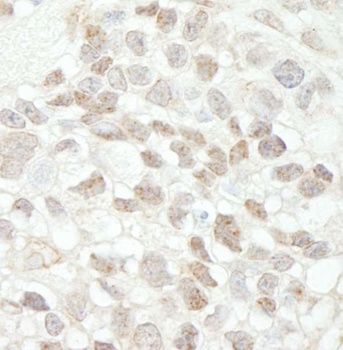 Rabbit anti-MED18 Antibody