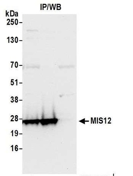 MIS12 Antibody