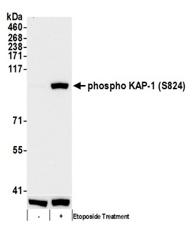 Rabbit anti-Phospho KAP-1 (S824) Antibody