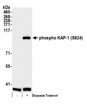 KAP-1, Phospho (S824) Antibody