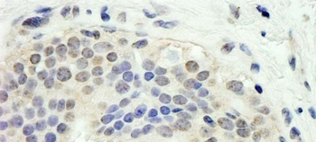 E2F1 Antibody