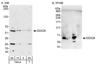 Rabbit anti-DDX28 Antibody