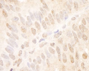 Rabbit anti-TCF12 Antibody