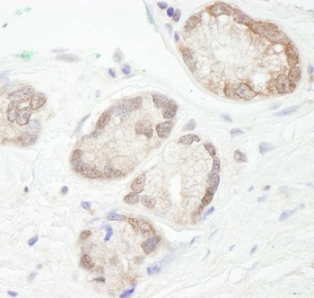 Rabbit anti-UBCH7 Antibody