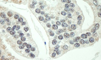 Rabbit anti-RNF40 Antibody