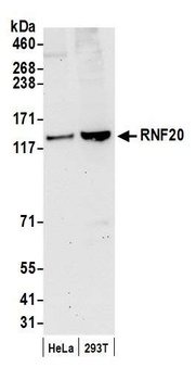 Rabbit anti-RNF20 Antibody