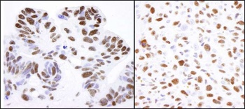 Rabbit anti-Nucleolin (NCL) Antibody