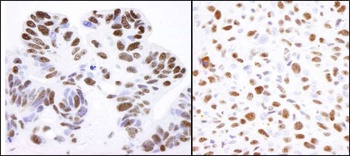 Nucleolin/NCL Antibody