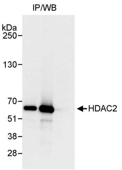 HDAC2 Antibody