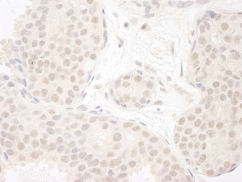 Rabbit anti-DDX23 Antibody