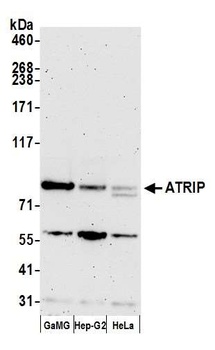 Rabbit anti-ATRIP Antibody