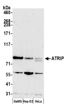 ATRIP Antibody