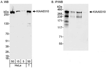 Rabbit anti-KIAA0310 Antibody