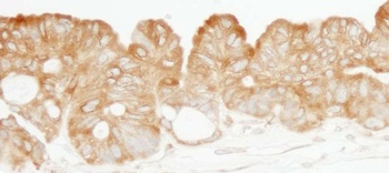 Rabbit anti-KARS Antibody